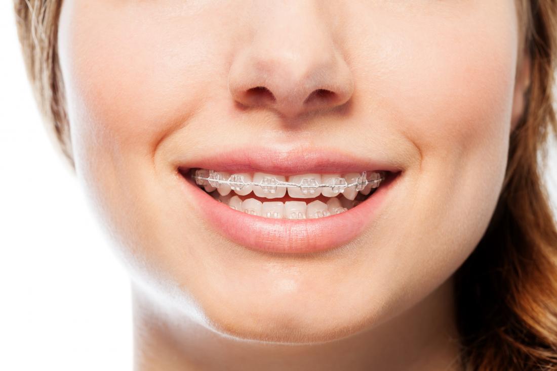 How Untreated Orthodontic Issues Affect Adults