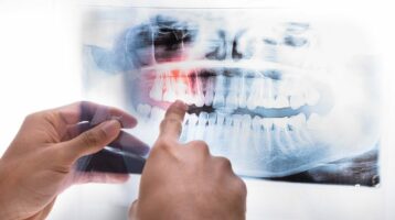 3D Dental Imaging