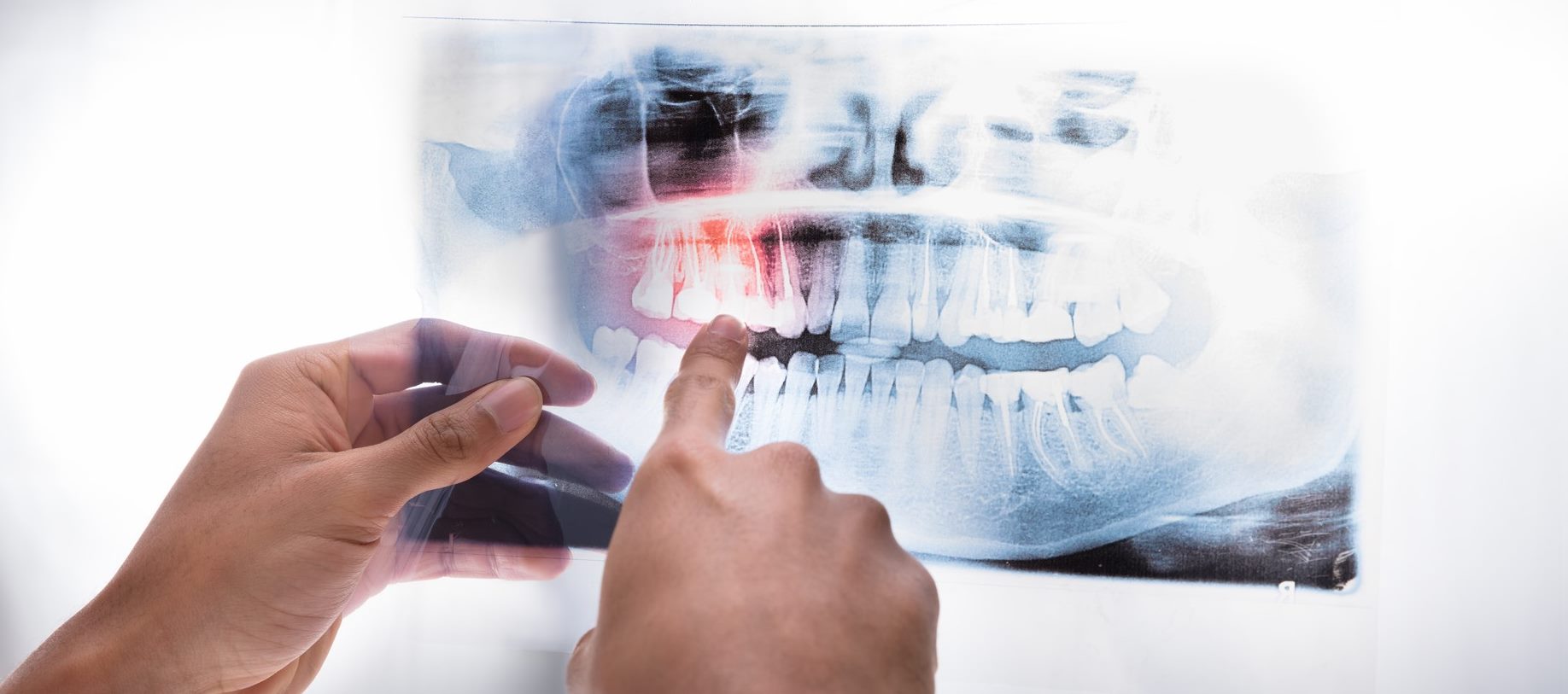 3D Dental Imaging at Yuma Smiles!