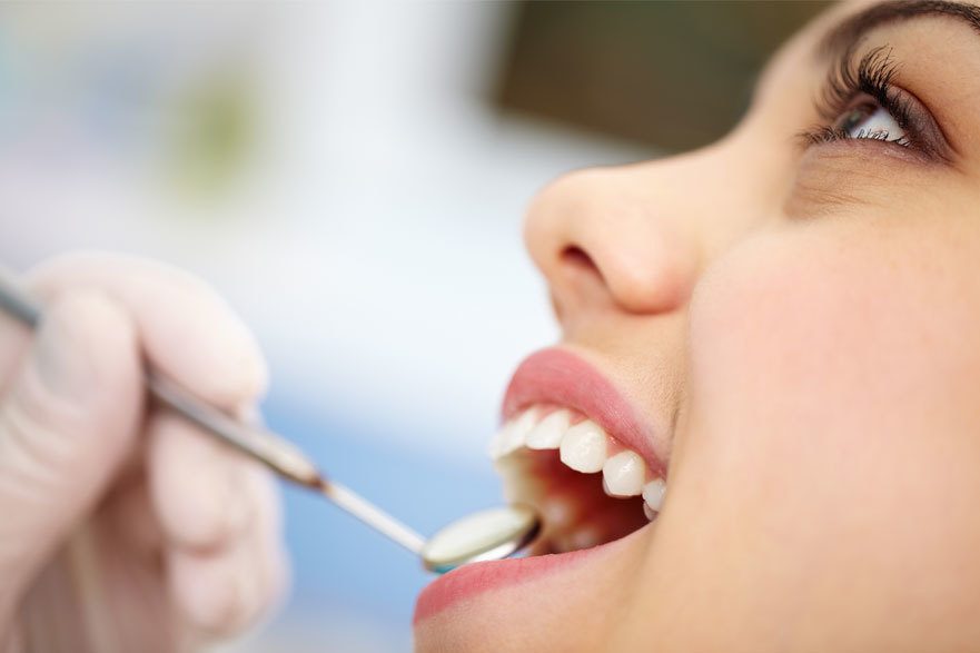 Finding the Right Cosmetic Service for Your Smile